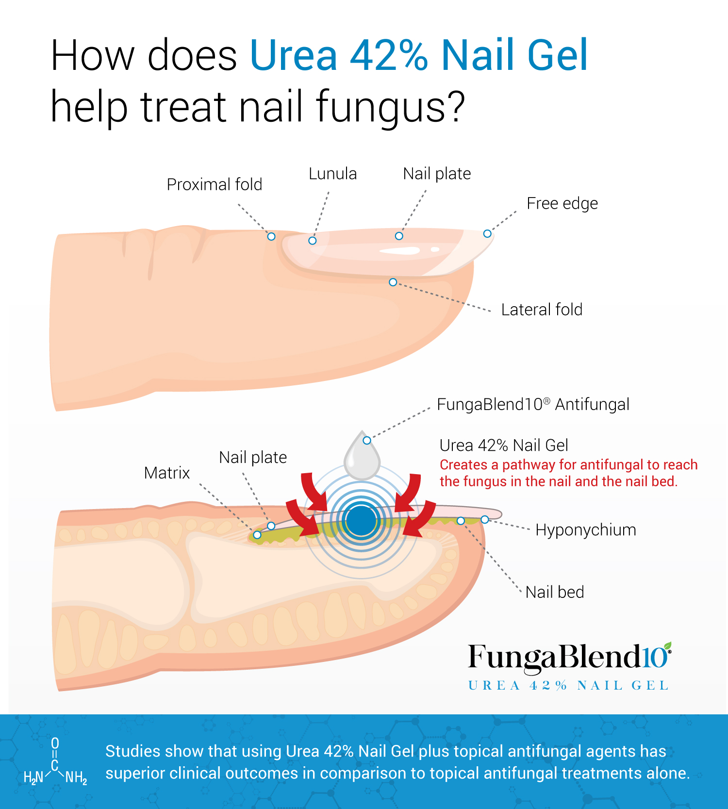 Urea-Nail-Diagram
